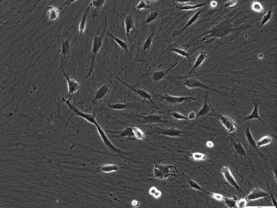 CELLvo™ Cord Blood Endothelial Progenitor Cells (hCB-EPC) (100x)