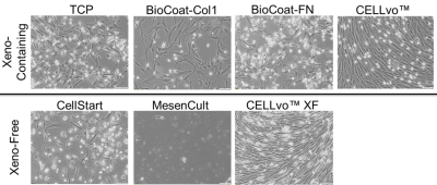 BM-MSC isolation from primary bone marrow mononuclear cells (100x) at day 14